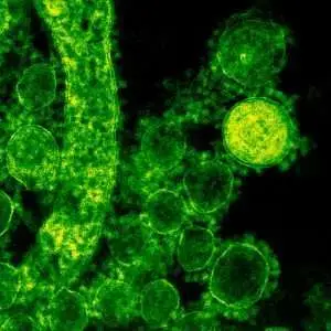 Green-tinted microscopic image of coronavirus particles illustrating viral structures.